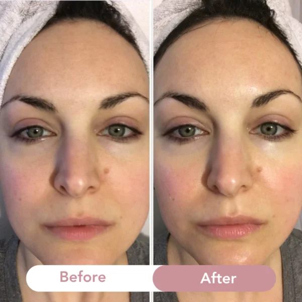 Aestheta Bio-Collagen Mask - Image 3