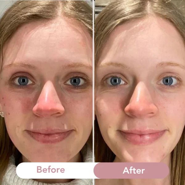 Aestheta Bio-Collagen Mask - Image 7